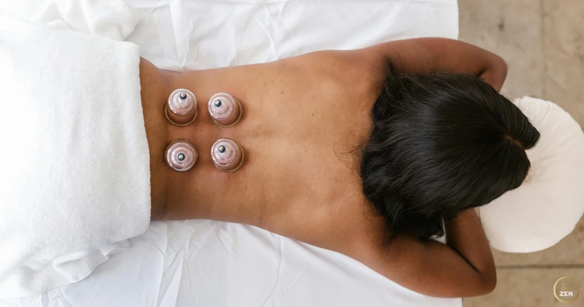 Best Cupping Therapy near me in Dubai