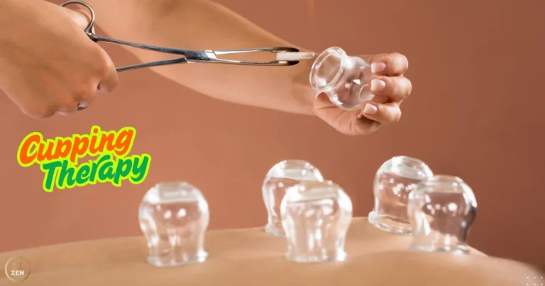 Cupping Therapy At Home Dubai
