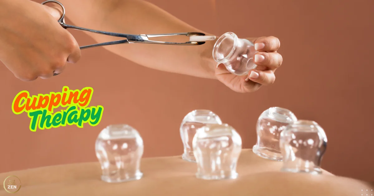 Cupping Therapy At Home Dubai